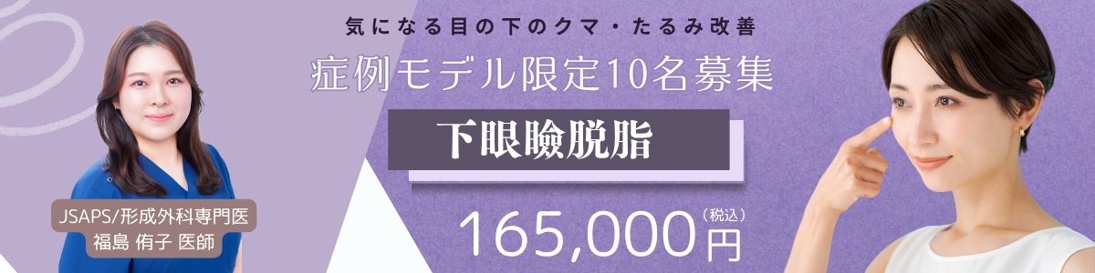 モニター価格02