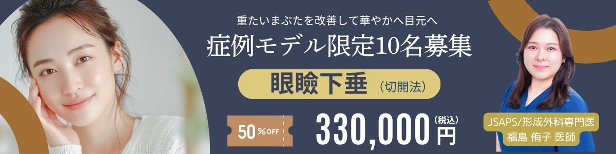 モニター価格02