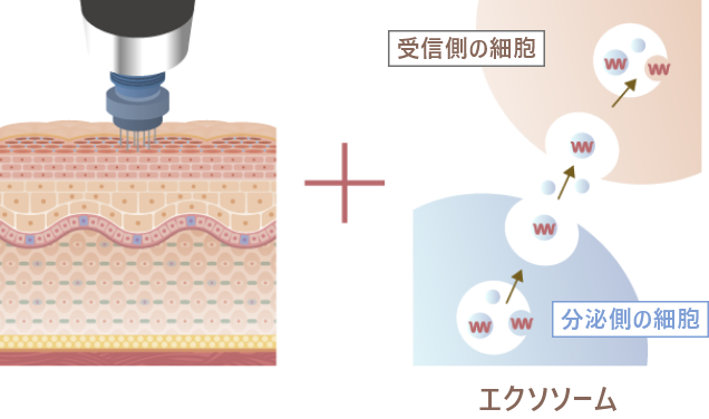 エクソソーム