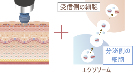 エクソソーム