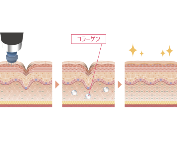 どうしてできるの？