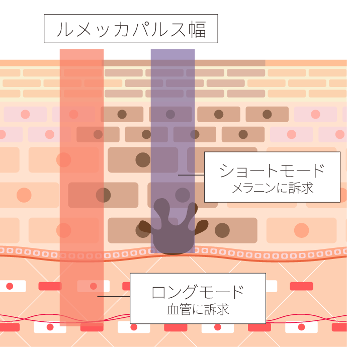 短いパルス幅と高出力が実現する『圧倒的な効果』