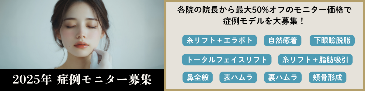 ２月モニター