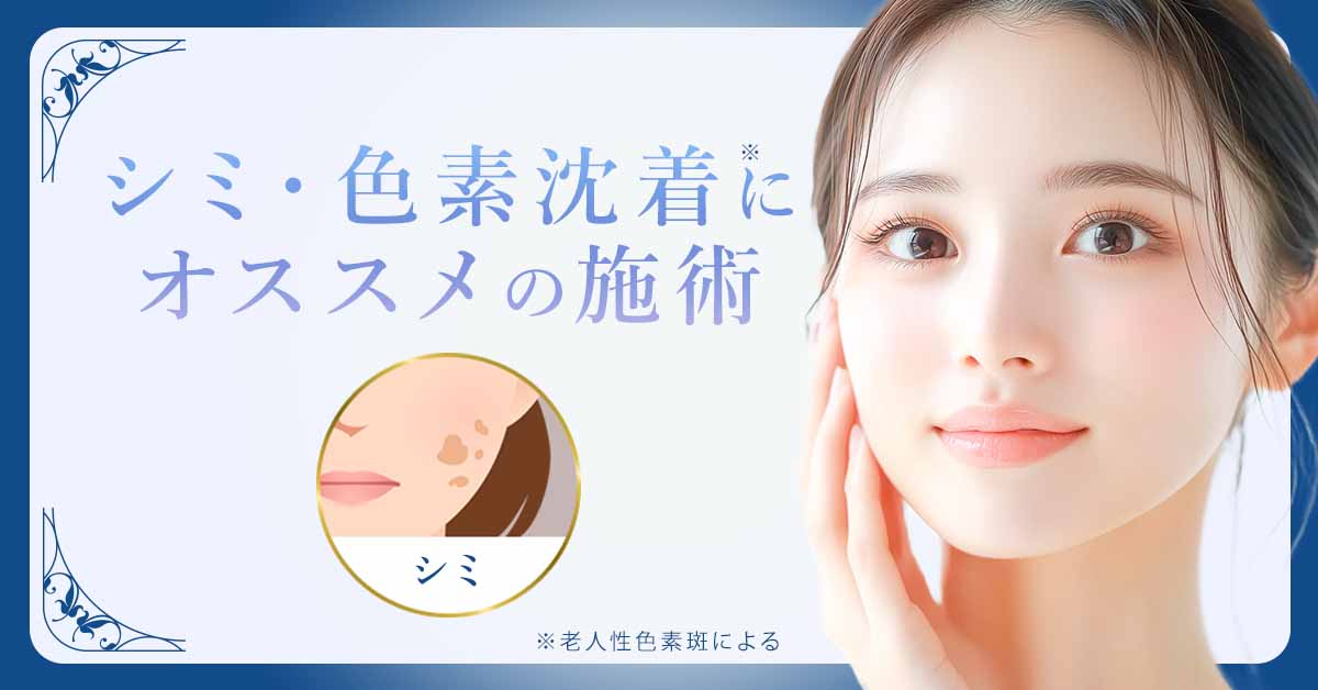 老人性色素斑によるシミ・色素沈着