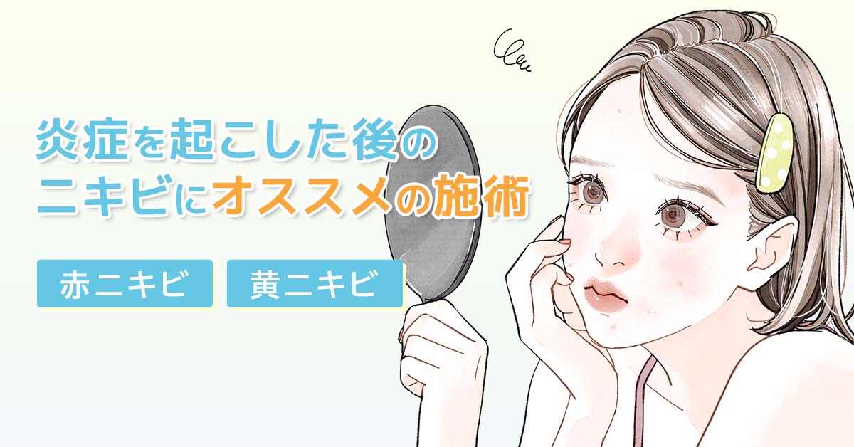 炎症を起こした後のニキビの治療（赤ニキビ・黄ニキビ）