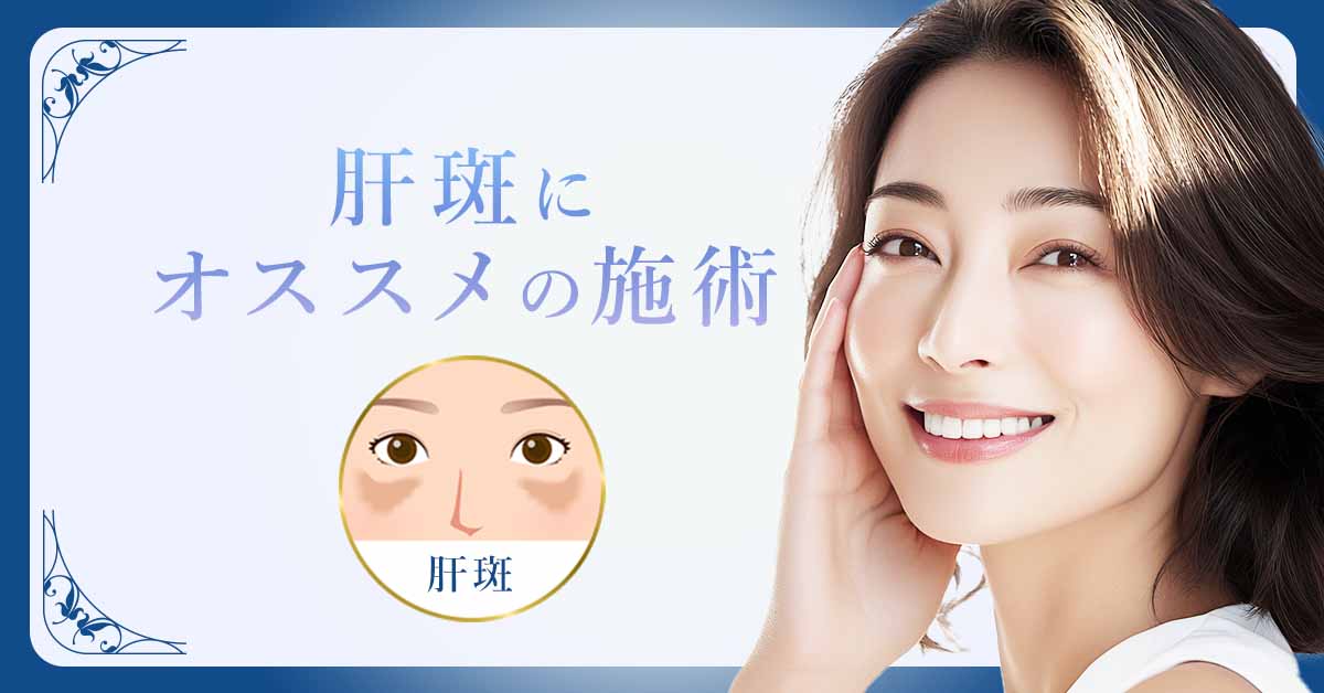 肝斑