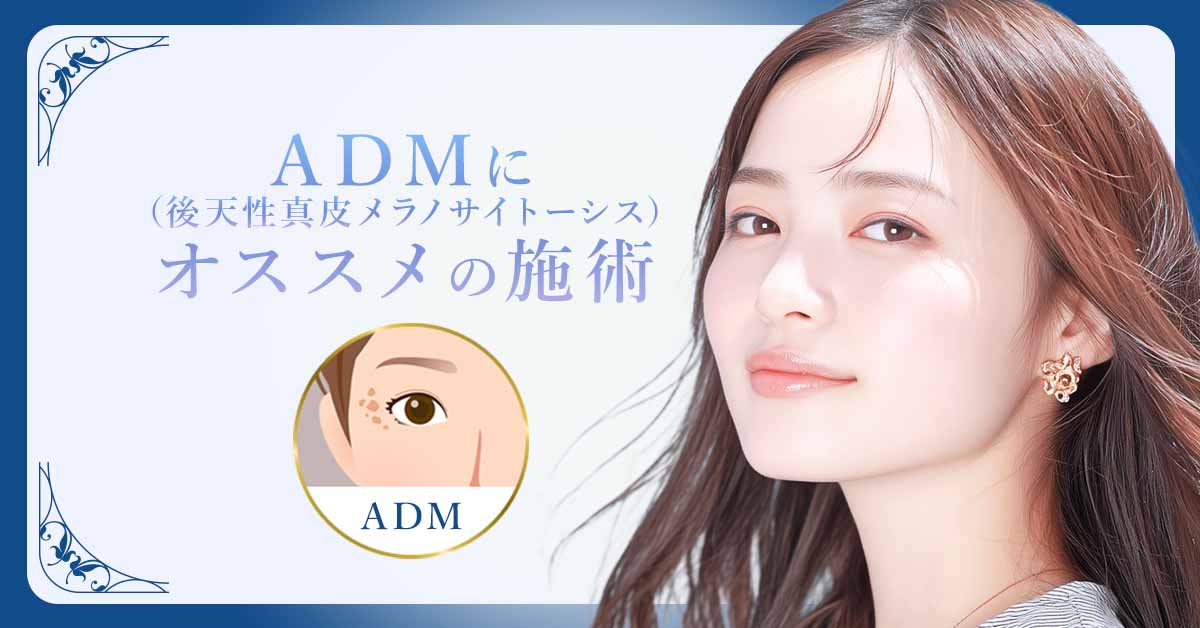 ADM（後天性真皮メラノサイトーシス）