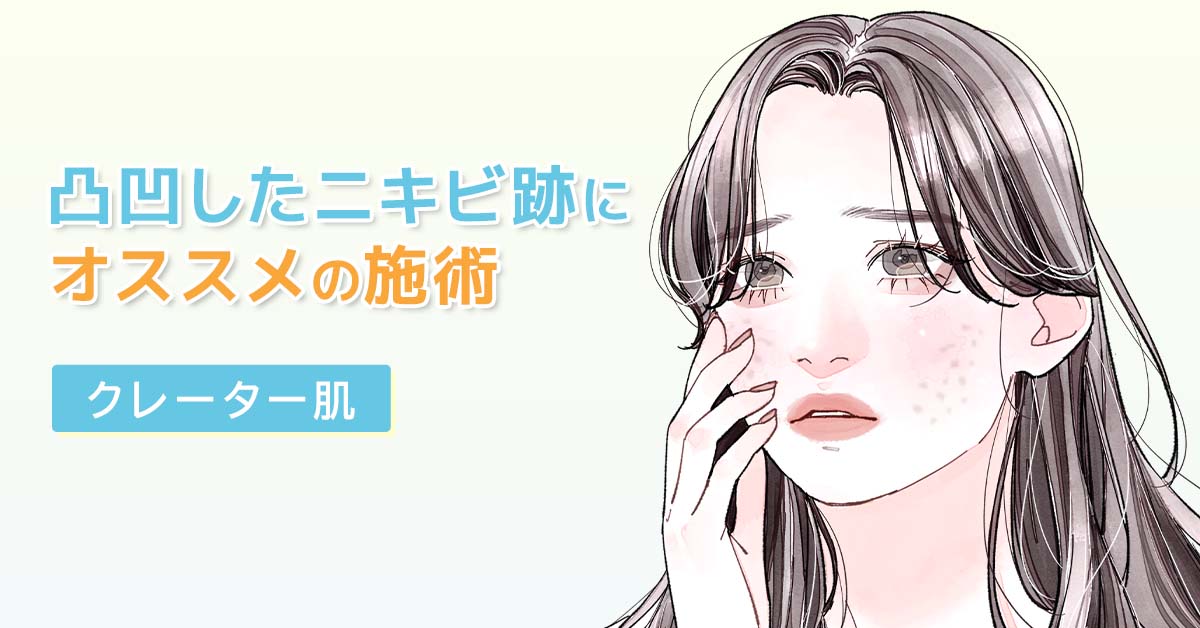 ニキビ跡治療（クレーター肌）