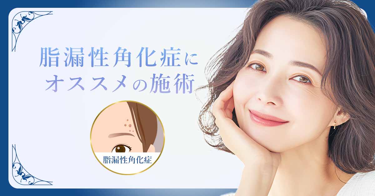 脂漏性角化症