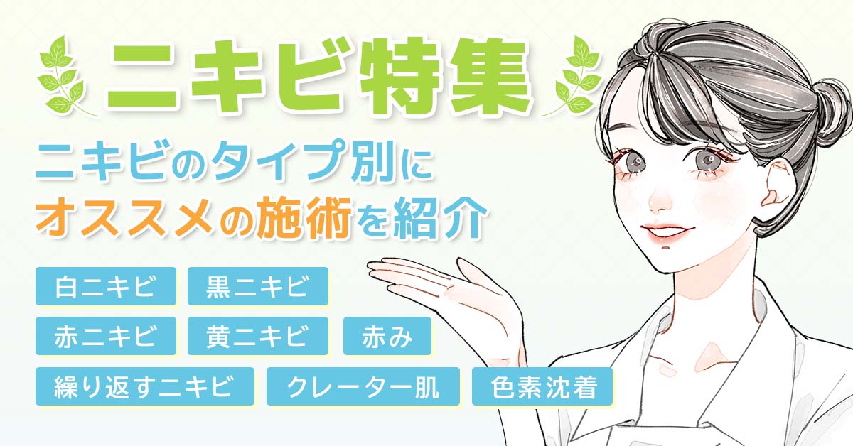 【特集】ニキビの悩みはオモスキで解決!