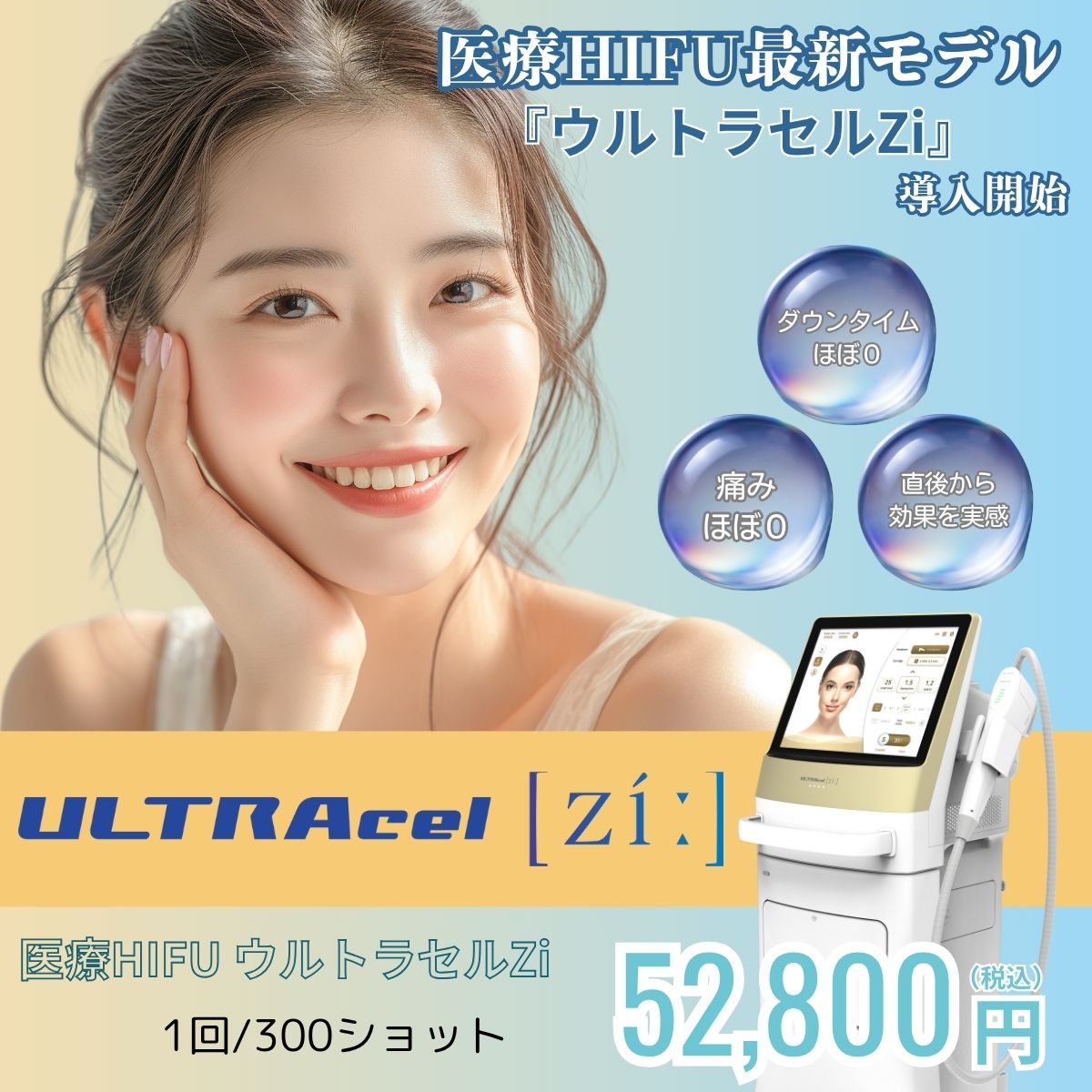 ウルトラセルZi導入CP