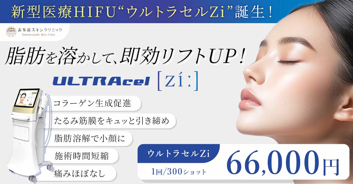 ウルトラセルZi