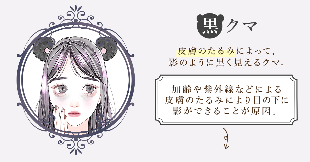 黒クマ