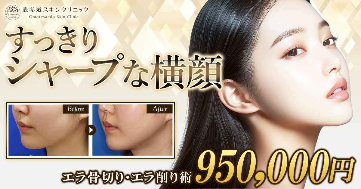 エラ骨切り・エラ削り術