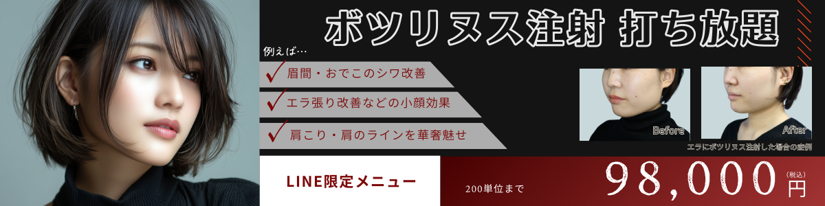 ボツリヌス注射打ち放題