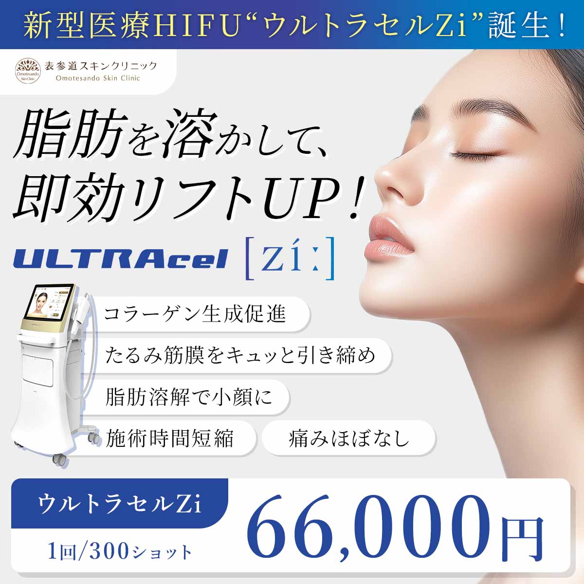 ウルトラセルZiのバナー