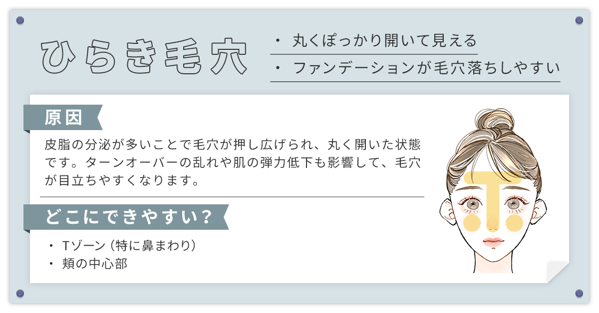 開き毛穴（皮脂毛穴）