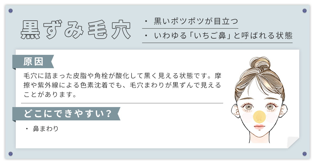 黒ずみ毛穴（角栓毛穴・詰まり毛穴）