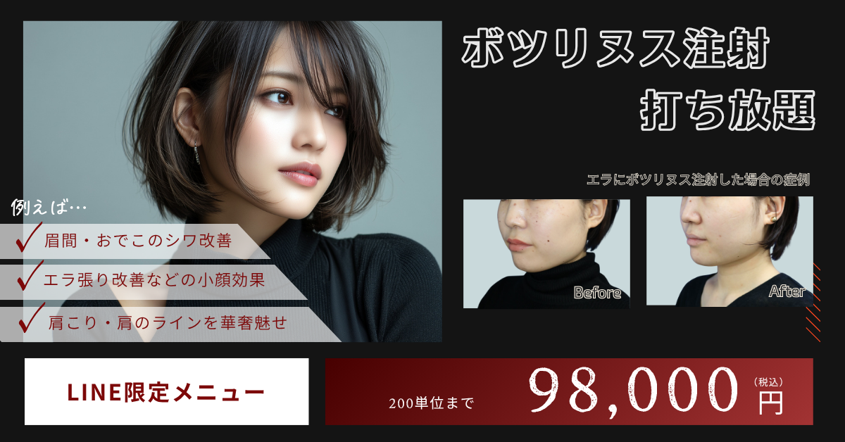 202510_ボツリヌス注射打ち放題