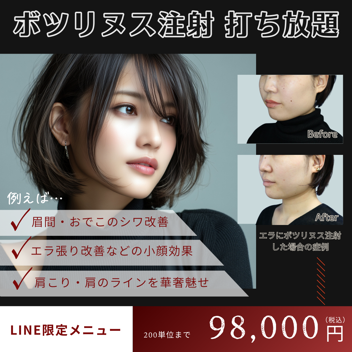 ボツリヌス注射打ち放題