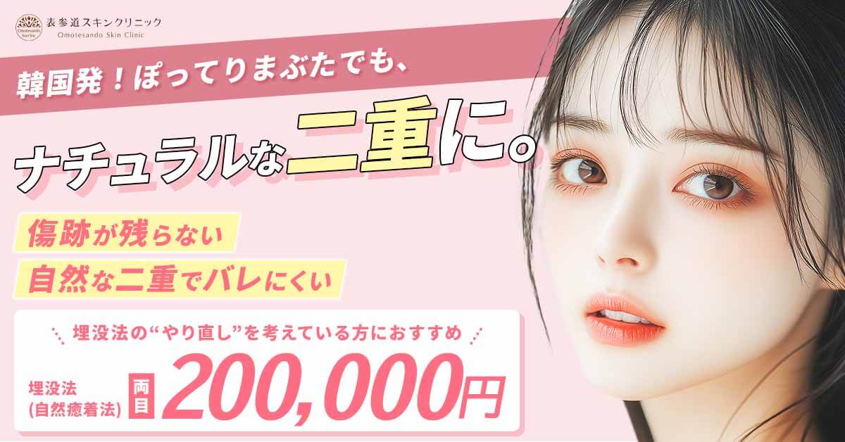 埋没法（自然癒着法）