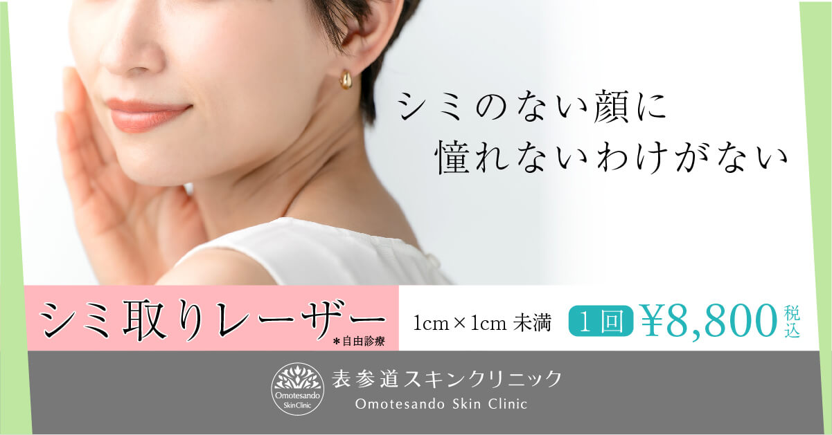 シミ取りレーザー